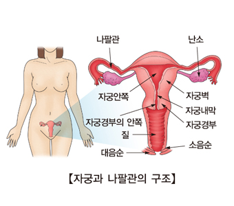 난소난관염