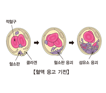 폰빌레브란트병